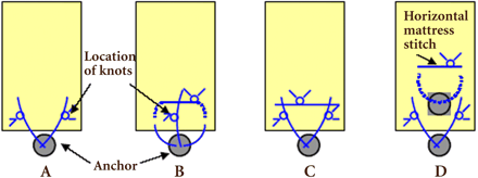 Biomechanical Evaluation of Arthroscopic Rotator Cuff Repairs